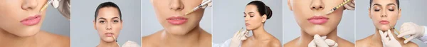 Collage Met Foto Van Vrouw Tijdens Lip Augmentation Procedure Banner — Stockfoto