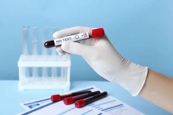 Scientist Holding Tube Blood Sample Label Hiv Test Light Blue — Fotografia de Stock
