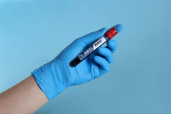 Scientist Holding Tube Blood Sample Label Hav Light Blue Background — Stockfoto