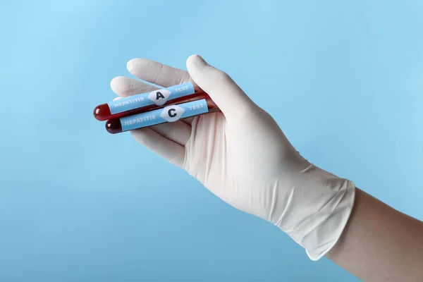 Scientist holding tubes with blood samples for hepatitis virus test on light blue background, closeup