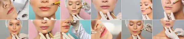 Collage Con Fotos Mujer Durante Procedimiento Aumento Labios Diseño Banner —  Fotos de Stock