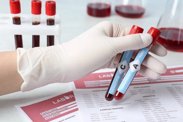 Scientist Holding Tubes Blood Samples Hepatitis Virus Test Laboratory Form — Foto de Stock