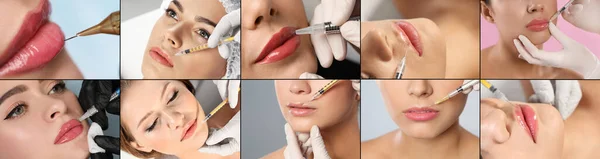 Kolaż Zdjęciami Kobiet Podczas Zabiegów Powiększania Ust Makijażu Stałego Zbliżenie — Zdjęcie stockowe