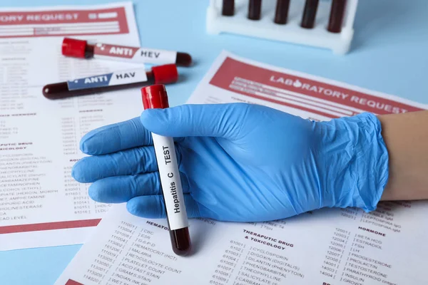 Wetenschapper Holding Tube Met Bloedmonster Label Hepatitis Test Buurt Van — Stockfoto