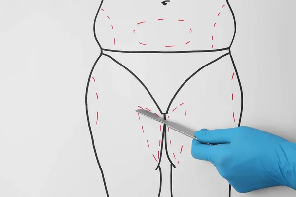 Doctor Holding Scalpel Drawn Human Body Marks White Background Top — Stockfoto