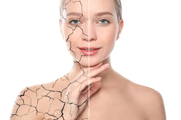 Collage Photos Woman Having Dry Skin Problem Dry Skin Problem — Fotografia de Stock