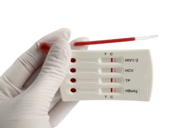 Doctor holding disposable express test for hepatitis and pipette with blood on white background, closeup