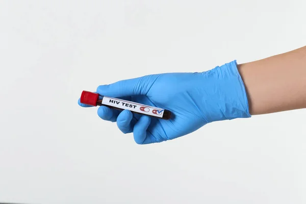 Scientist Holding Tube Blood Sample Label Hiv Test Light Background — Stockfoto