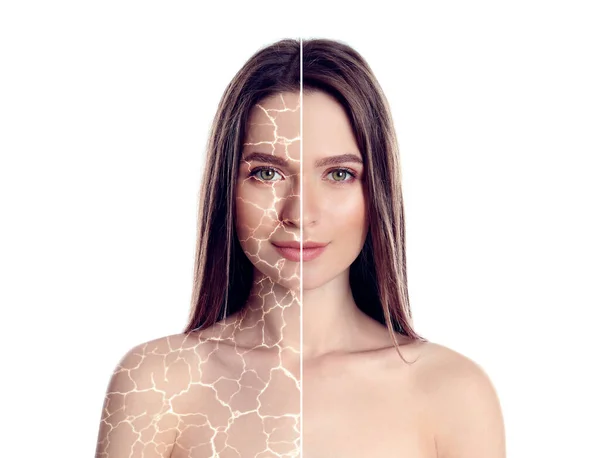 Collage Photos Woman Having Dry Skin Problem Dry Skin Problem — ストック写真