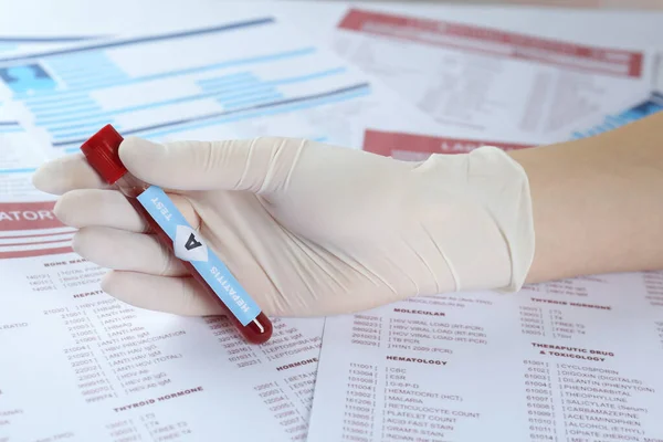 Tutkija Joka Pitää Putkea Verinäytteellä Etiketillä Hepatiitti Testi Laboratoriomuotoja Vastaan — kuvapankkivalokuva