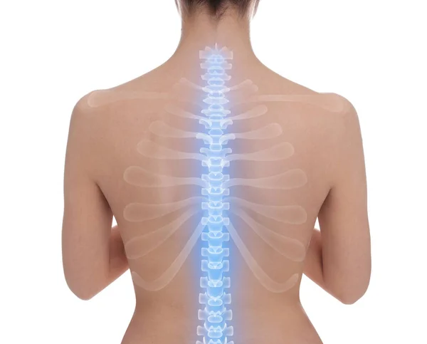 白い背景に健康な背骨を持つ女性 バックビュー — ストック写真