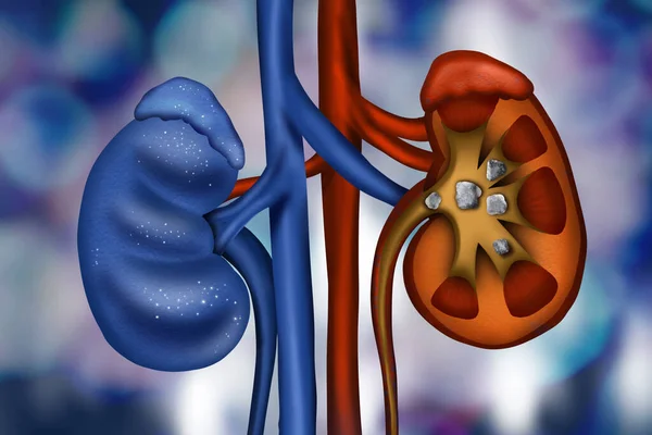 Illustration Healthy Diseased Kidneys Blue Background — Fotografia de Stock