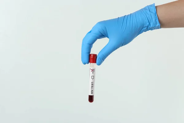 Scientist Holding Tube Blood Sample Label Hiv Test Light Background —  Fotos de Stock