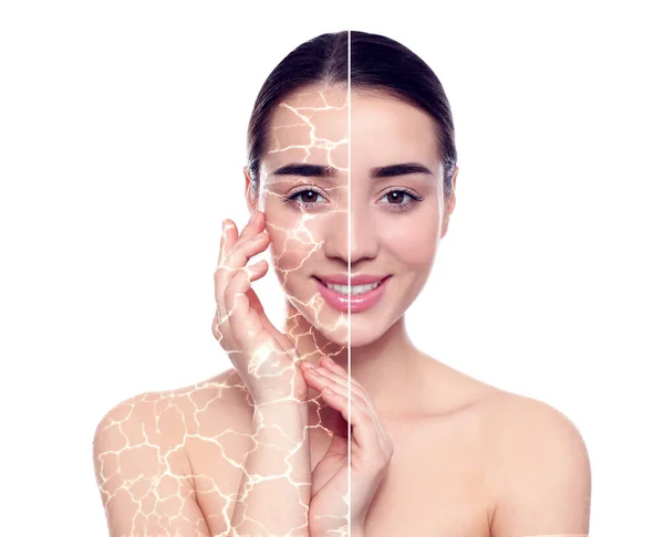 Collage Photos Woman Having Dry Skin Problem Dry Skin Problem — ストック写真