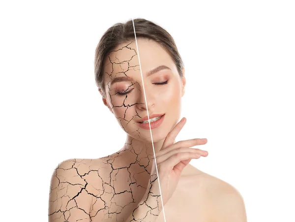 Collage Photos Woman Having Dry Skin Problem Dry Skin Problem — Fotografia de Stock
