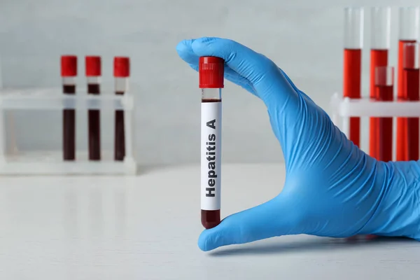 Tudós Gazdaság Cső Vérmintával Címke Hepatitis Fehér Asztal Closeup — Stock Fotó