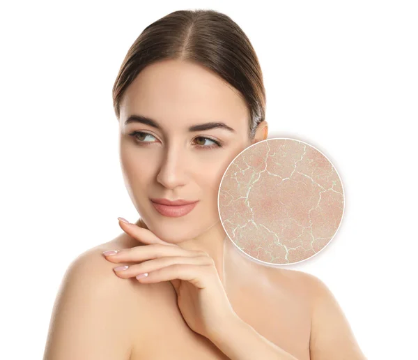 白い背景に顔の乾燥肌の問題を持つ若い女性 — ストック写真