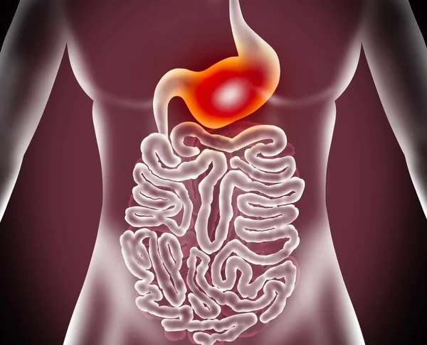 Illustration Woman Suffering Stomach Disease Gastroenterology — Stock Photo, Image