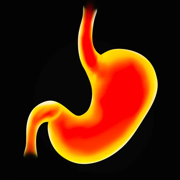 Illustration Diseased Stomach Black Background Gastroenterology — Stok fotoğraf