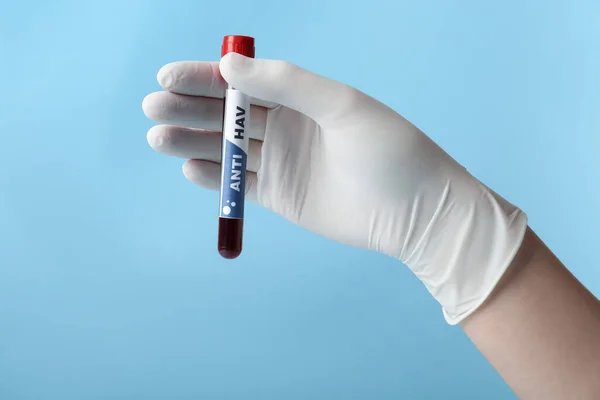Cientista Segurando Tubo Com Amostra Sangue Etiqueta Hav Fundo Azul — Fotografia de Stock