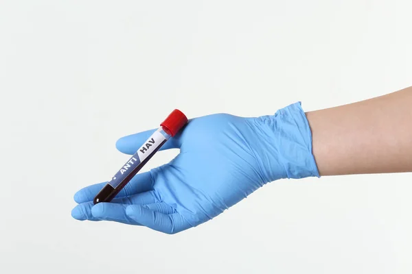 Scientist Holding Tube Blood Sample Label Hav Light Background Closeup — Fotografia de Stock