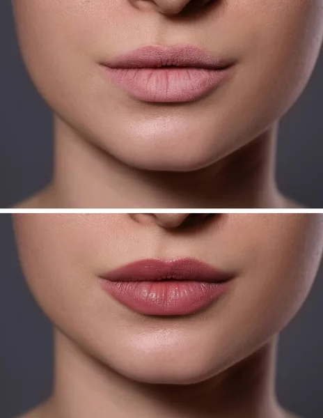 Collage Photos Woman Dry Moisturized Lips Closeup — Stockfoto
