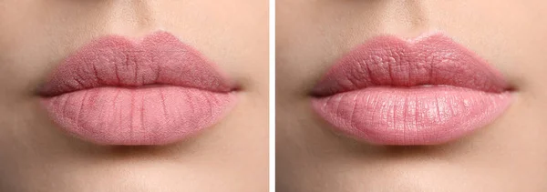 Collage Photos Woman Dry Moisturized Lips Closeup Banner Design — стоковое фото