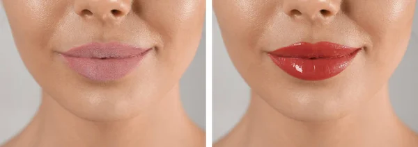 Collage Photos Woman Dry Moisturized Lips Closeup Banner Design — Foto Stock