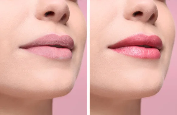 Collage Photos Woman Dry Moisturized Lips Closeup — Photo