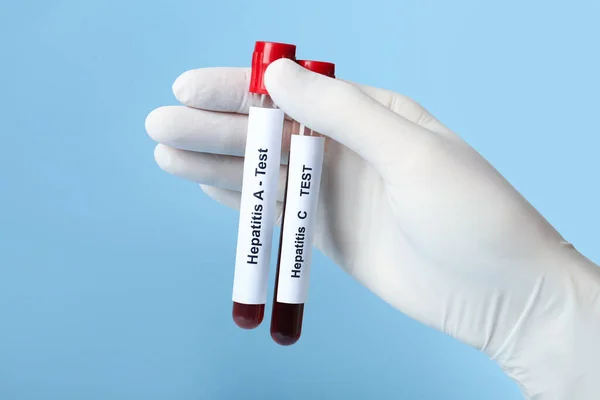 Scientist holding tubes with blood samples for hepatitis virus test on light blue background, closeup
