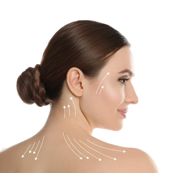 Beautiful Woman Facelift Cosmetic Surgery Procedure White Background — Stockfoto