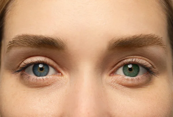 Woman Beautiful Eyes Different Colors Closeup Heterochromia Iridis — 스톡 사진