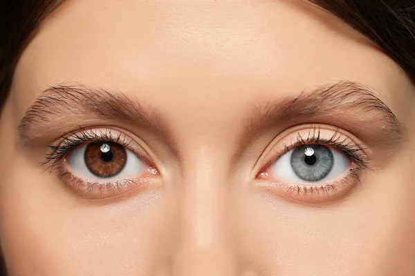 Woman Beautiful Eyes Different Colors Closeup Heterochromia Iridis — Foto de Stock