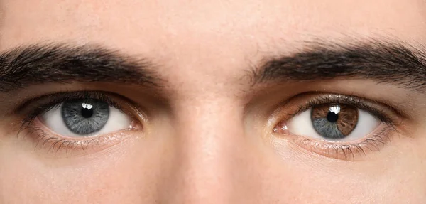 Man Beautiful Eyes Different Colors Closeup Heterochromia Iridis — Foto Stock