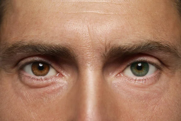 Man Beautiful Eyes Different Colors Closeup Heterochromia Iridis — Fotografia de Stock