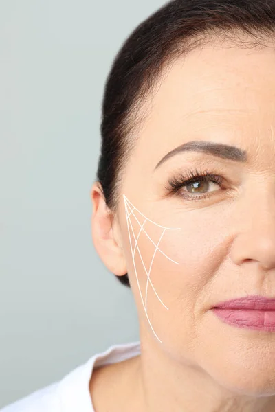 Beautiful Mature Woman Facelift Cosmetic Surgery Procedure Grey Background Closeup — Stok Foto