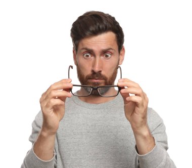 Man suffering from eyestrain on white background