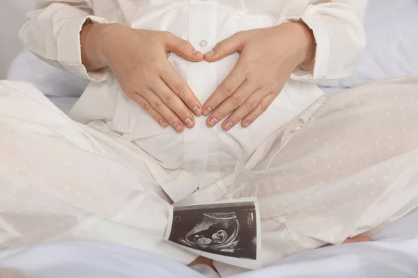 Pregnant Woman Ultrasound Scan Bed Closeup — Foto Stock