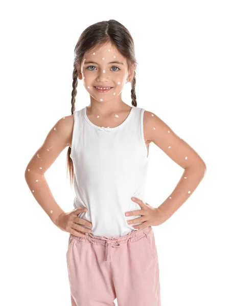 Kleines Mädchen Mit Windpocken Auf Weißem Hintergrund — Stockfoto