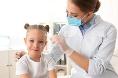 Doktor, klinikte suçiçeği olan küçük bir kızın cildine krem sürüyor. Varicella zoster virüsü