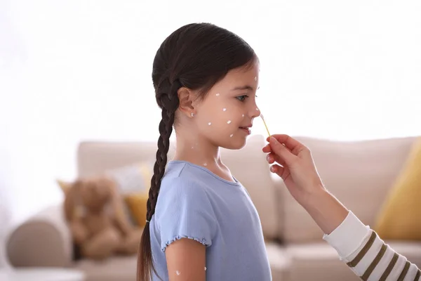 Mère Appliquant Crème Sur Peau Fille Avec Varicelle Maison — Photo