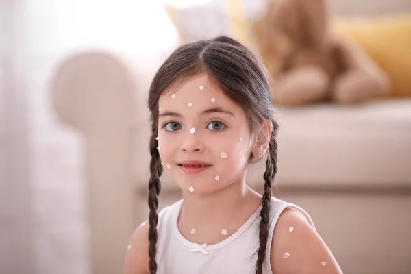 Adorabile Bambina Con Varicella Casa — Foto Stock