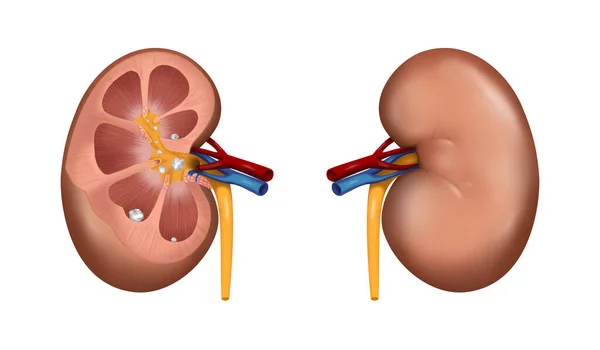 Illustration Human Kidneys Stones White Background — Stok fotoğraf