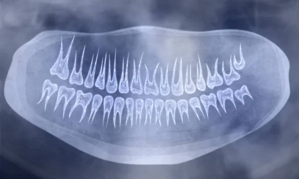 X-ray picture of oral cavity with teeth