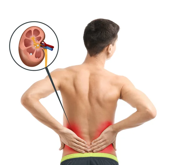 Man Suffering Pain Because Kidney Stones Disease White Background — Zdjęcie stockowe