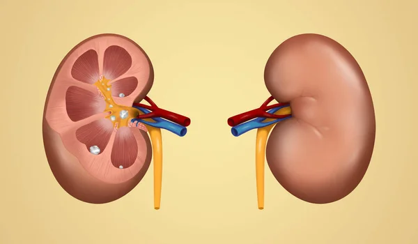 Illustration Human Kidney Stones Beige Background Banner Design — Fotografia de Stock