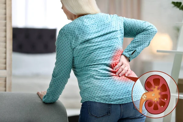Mature Woman Suffering Pain Because Kidney Stones Disease Home — Stockfoto