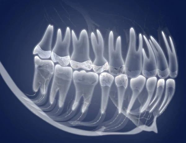 X-ray picture of oral cavity with teeth
