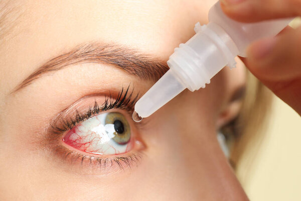 Woman using eye drops on light background, closeup
