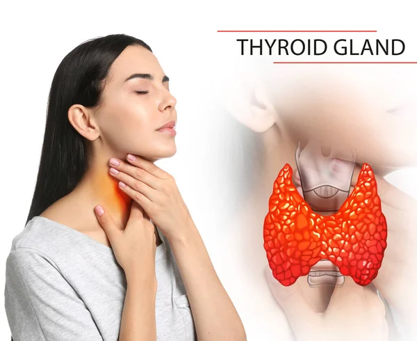 Woman Illustration Thyroid Gland White Background — Stock Fotó